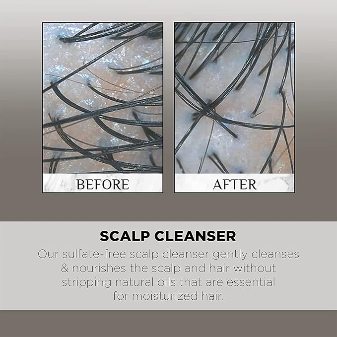 Controlled Chaos As Seen on Shark Tank Sulfate Free Hair Cleanser for Build Up – Deep Cleansing & Hydrating Scalp Cleanser for All Hair Types – Ideal for both Men & Women, Made In USA (8oz)