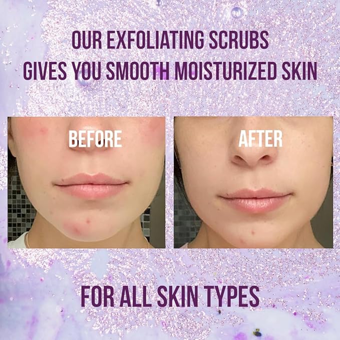 Blueberry Body Scrub, Pure Organic Face Exfoliant for Super Soft Skin, Anti Cellulite & Exfoliator, Natural Skin Care Formula Helps with Stretch Marks, Eczema, Acne & Varicose Veins for Men and Women