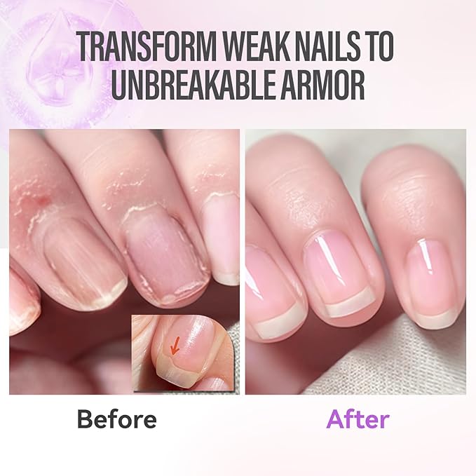 CHUCHU Nail Strengthener - Blueberry Scent Nail Repair Growth Moisturizing Treatment - Natural Jojoba Vitamin B & E Cuticle Oil for Dry Cracked Nails