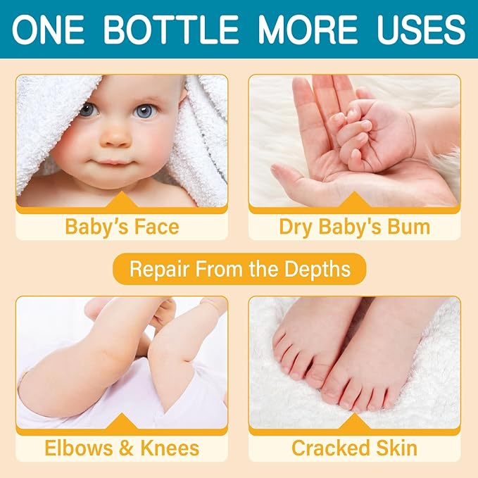 AOAO Body Butter for Kids - Prevents Cracked Skin Cream, Nourishing Moisturizing Kids Body Lotion - Shea Butter & Vitamin E Rich Formula, Paraben, Phenoxyethanol Free, 3.53 Oz/100g