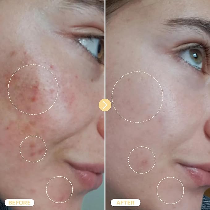 BASE LABORATORIES Hypochlorous Acid Spray for Face & Skin - Travel Size - Magic Facial Toner Spray & Cleaner - Skin Repair Solution helps reduce redness, Irritations, acne - HOCL Molecule Spray 2oz