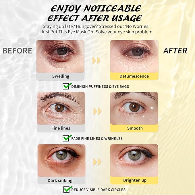 24k Gold Under Eye Patches & Caffeine Eye Masks, Collagen Eye Patches for Dark Circles Undereye Bags Wrinkles and Puffiness, Eye Skin Care Gift for Her