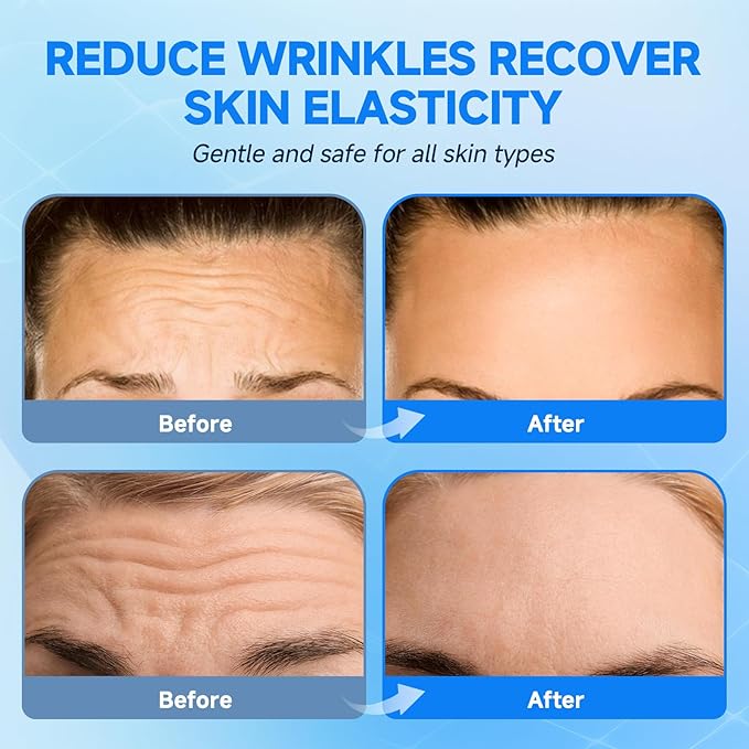 POSTA 12pcs Forehead Wrinkle Patches, Smooth Wrinkles Fine Lines, Anti-Wrinkle Patches with Hydrolyzed Collagen, Aloe, Vitamin E, Forehead Wrinkles Treatment for Women and Men