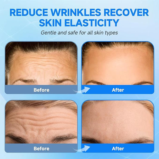 POSTA 12pcs Forehead Wrinkle Patches, Smooth Wrinkles Fine Lines, Anti-Wrinkle Patches with Hydrolyzed Collagen, Aloe, Vitamin E, Forehead Wrinkles Treatment for Women and Men