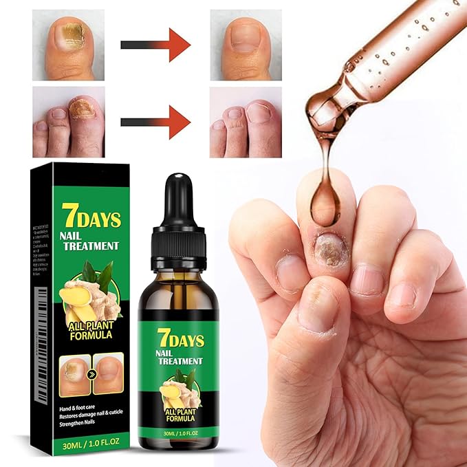 7days Nail Treatment, Ginger Nail Treatment, Multi-Purpose Nail Repair, Nail Nutrient Oil Strengthener Oil Serum Ginger Nail Growth Oil