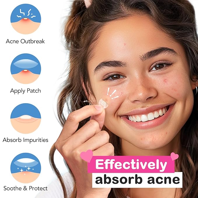 Pimple Patches for Face 7 Sizes Day and Night Acne Patches Heart Zit Patches Cute Spot Stickers with Tea Tree & Centella Oil, Strong Adhesion Zit Covers (412 Count)