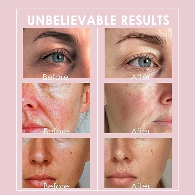 Ice Globes for Face and Eyes, Cooling Facial Facial Roller Balls, Beauty Massage Tools to Reduce Puffiness, Redness, Fine Lines, Cryo Facial Sticks for Home Spa Skincare Routine, Glitter Pink