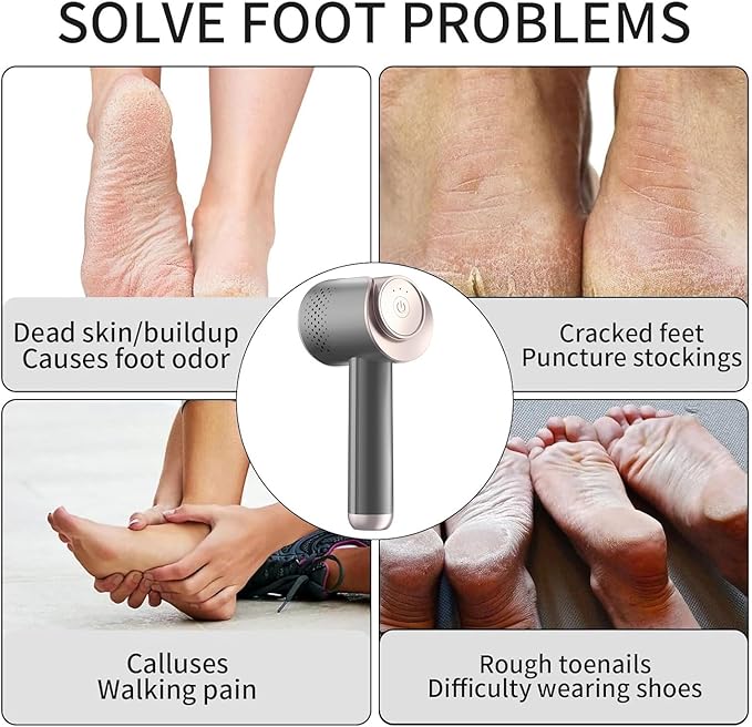Electric Foot Callus Remover, Rechargeable Foot File Callus Remover for Feet, Portable Foot Scrubber with 10in1 Pedicure Tools for Feet Cracked Heel Dead Skin, 6 Rollers, 3 Speed
