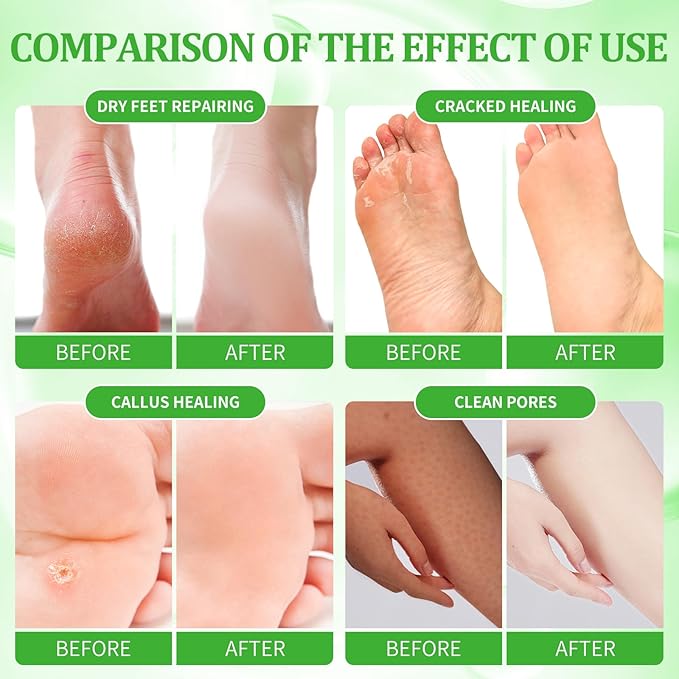 Pedicure Kit Foot Soak Set: Bubble Salt, Sugar Scrub, Massage Mask, Massage Lotion in a Box, 4 Step Foot Spa Kit for Dry Feet, Calluses and Tired Feet(1 Set Peppermint)