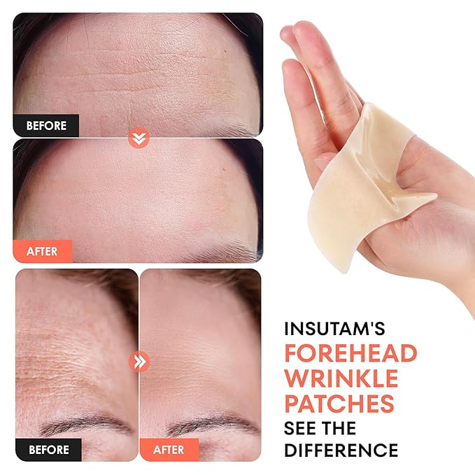 Forehead Wrinkle Patches for Anti-wrinkles: Overnight Face Wrinkles Patches to Lift Smile Lines for Women (12PICS, Rose Gold)