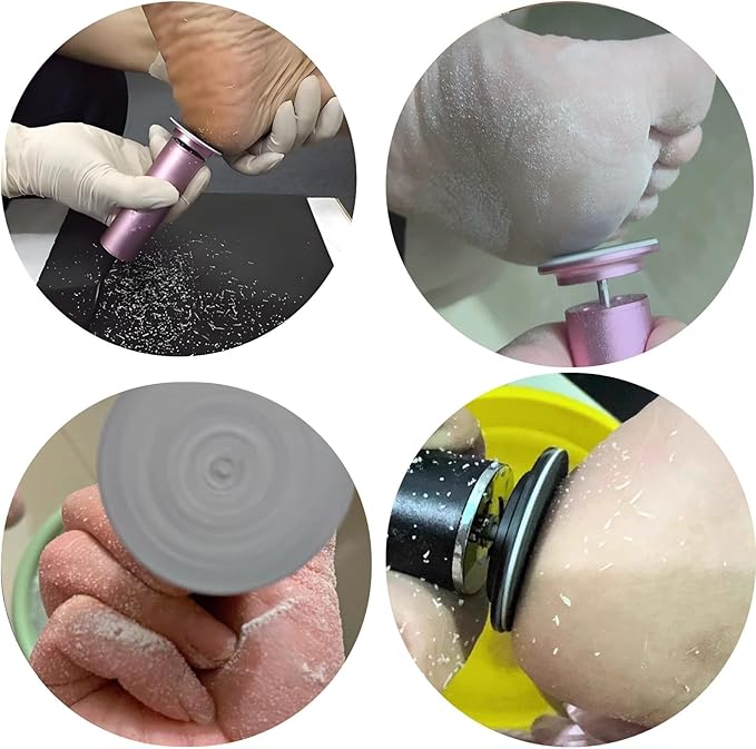 Electric Feet Callus Remover,Foot File Grinder Tool with Speed Controller and 60pcs Replacement Sandpaper Disk,Pedicure Tools for feet for Men Women Dead Dry Crack Skin Calluses
