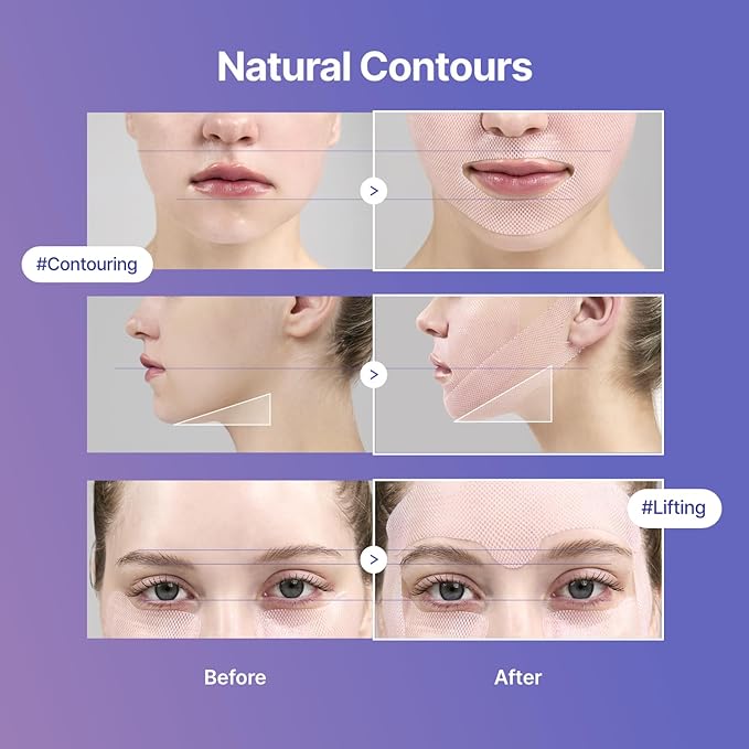 MEDITHERAPY Tension Up Mask 5EA - Korean Collagen Face V Line Lifting Mask - Hydrating Firming & Skin Tightening for Sharp & Sculpted Contour - Matrixyl & Peptide Gel Facial Mask for Youthful Radiance