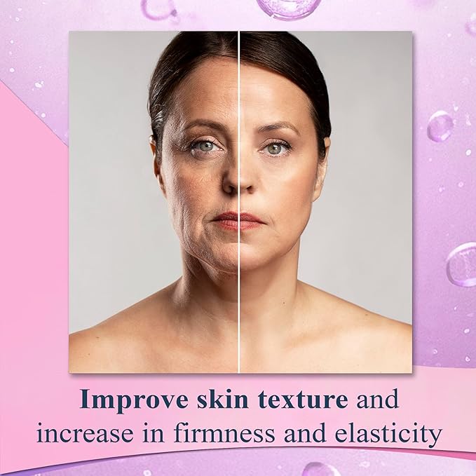 Elite Serum 10 - Natural Anti Aging Eye Serum and Anti Wrinkle Treatment - Eye Bags and Dark Circles Remover with Advanced Formulation of Hyaluronic Acid, Collagen, Argireline and Peptides