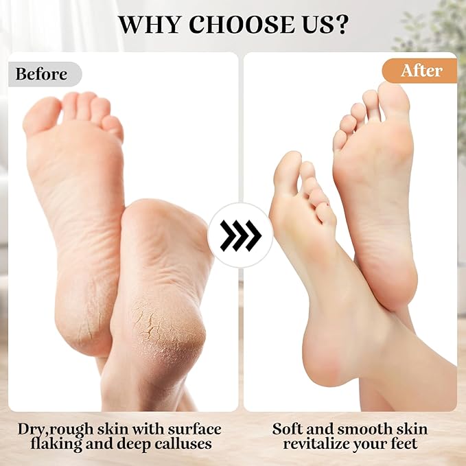 Electric Callus Remover Foot File - Rechargeable Callus Remover Pedicure Tools for Feet Foot Scrubber File Foot Care Grinder with 3 Grinding Heads 2 Speeds for Men Women Dry Callus Dead Skin (Blue)