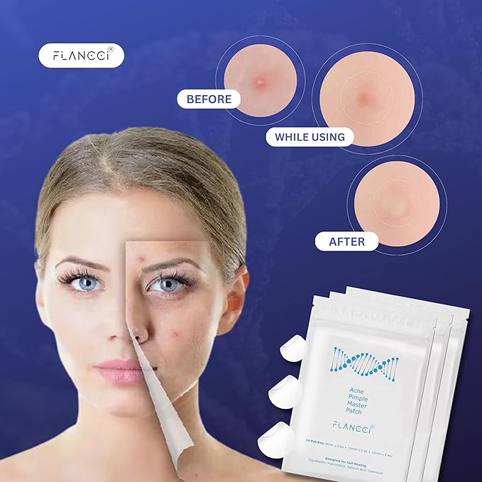 Pimple Patch Acne Patches Facial Skin Care Products, Blackhead Remover Skincare, Pimple Patch for Face and Hydrocolloid Acne Treatment Patch Salicylic Acid, Acne Spot Treatment (24 Count (Pack of 1))