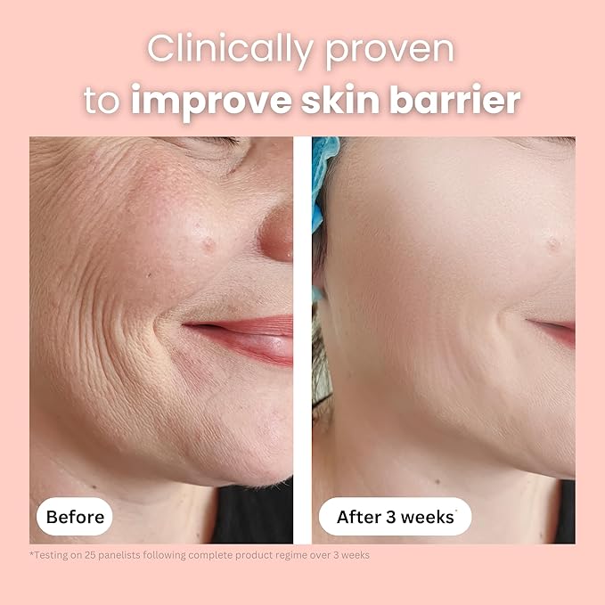 Organic Bee Venom + Manuka Honey Face Serum | Hydrating, Resurfacing, Collagen Booster | 2 month supply, 1oz/30ml | Made in New Zealand