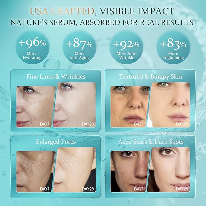 Face Serum - Facial Serum for Fine Lines & Wrinkles Hydrating and Moisturizing, 1.18 Fl Oz