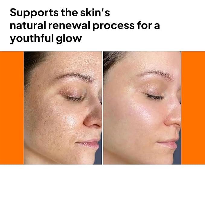 pH Lab Kojiso Skin Serum, Even Skin Tone (Pack of 1)