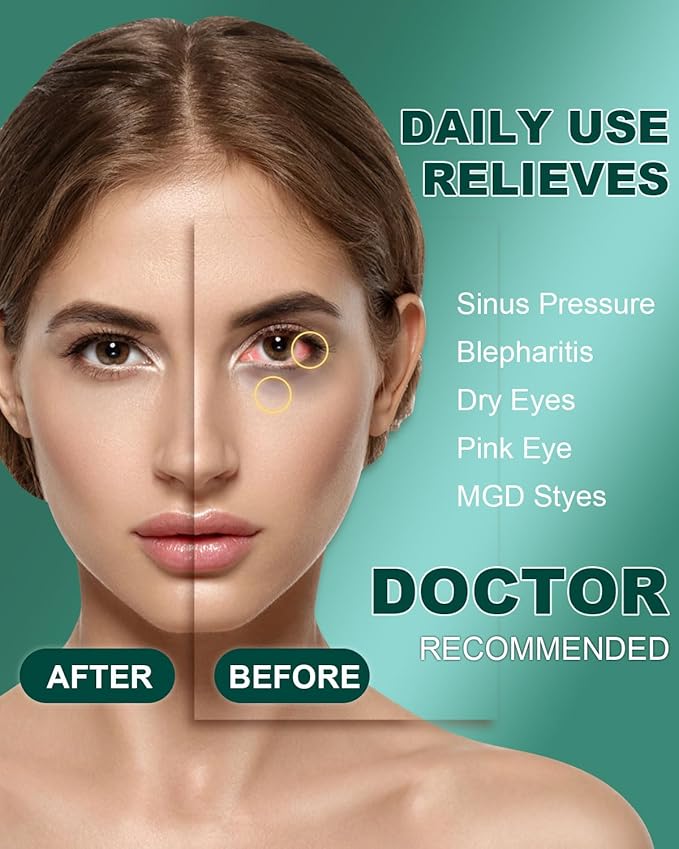 ProCIV 30 Packs Steam Eye Mask, Heated Eye Masks Relaxing Gifts for Women Soothing Eye Fatigue Hot Sleep Mask, Warm Eye Compress for Dry Eyes, Disposable Mask for Travel Essentials