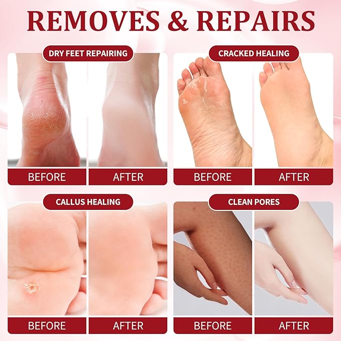 Pedicure Kit Foot Soak Set: Bubble Salt, Sugar Scrub, Massage Mask, Massage Lotion in a Box, 4 Step Foot Spa Kit for Dry Feet,Tired Feet (1 Set Pomegranate)