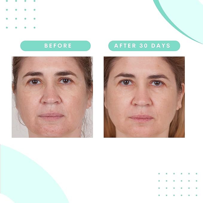 Serious Skincare Glycolic Skin Renewal Set - Retexturizing Serum - Facial Moisture Cream - Face Wash Cleanser - Balancing Blue Tansy Extract - Improve Appearance of Lines, Wrinkles and Enlarged Pores