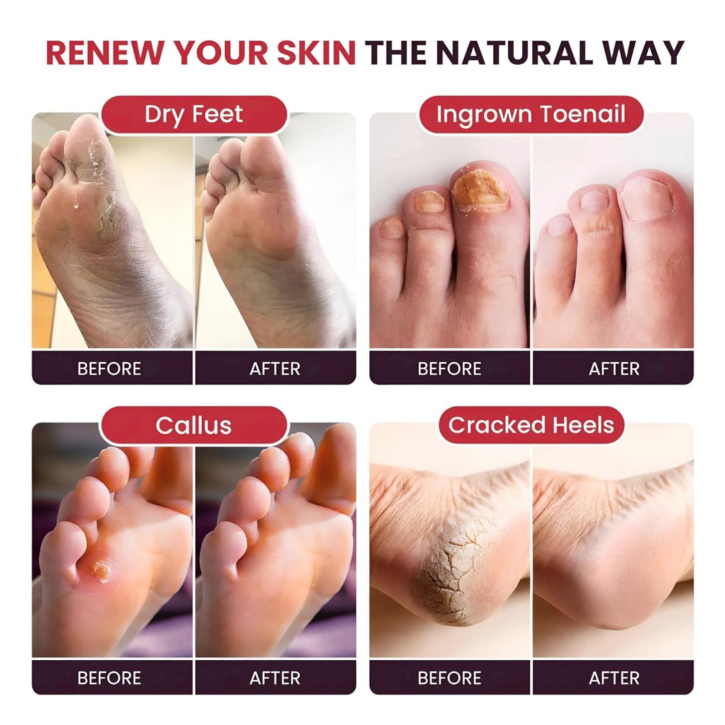 Tea Tree Oil & Muscle Foot Soak with Epsom Salts - All-Natural Salts for Post-Workout Recovery - Softens Calluses, Soothes Sore & Tired Feet, Foot Odor Control, Spa Pedicure, Made in USA, Pack of 2