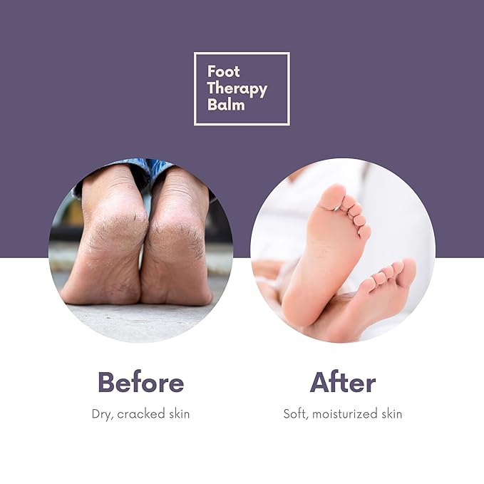 Victoria's Lavender Heel Balm Stick – Ultra-Rich Foot Therapy Balm for Dry, Cracked Feet – Heel Softener for Cracked Heels and Rough Skin – Dry Heels Treatment for Men and Women – Lavender Mint, 2.5oz