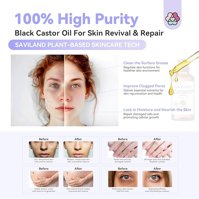 SAVILAND Jamaican Black Castor Oil: 100% Pure, Organic, Unrefined for Hair, Eyebrow, Face, Skin, Body & Home Care