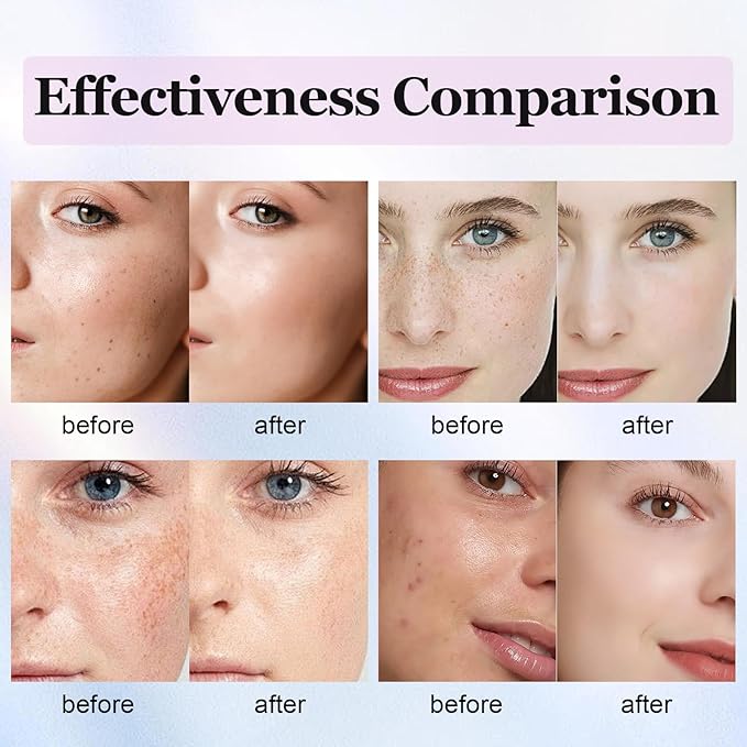 Dark Spot Remover for Face Body, Dark Spot Corrector Cream for Sun Spots, Age Spots, Brown Spots, Melasma Natural Dark Spot Remover Skin Care with Niacinamide Vitamin C for Women (1.0 Fl Oz)