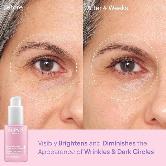 Alpyn Instant Bright Eye with Peptides & Niacinamide | Brightens Dark Circles, Visibly Firms & Softens Fine Lines | 0.5 Fl Oz / 15 ml