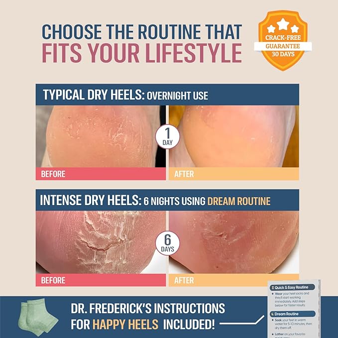 Dr. Frederick's Original Moisturizing Heel Socks for Cracked Heel Treatment - 2 Pairs - Socks for Dry Feet - Cracked Skin Repair & Overnight Hydration - Foot Care for Women & Men - Shea Butter