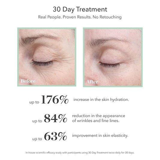 BIOEFFECT 30 Day Anti-Aging Treatment for Face and Neck With 3 Plant Based EGF Growth Factors & Hyaluronic Acid, Hydrating, Wrinkle-Fighting Firming Facial Serum