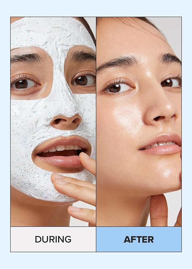 I DEW CARE Wash Off Face Mask - Cake My Day | With Hyaluronic Acid, Self Skin Care, Facial Treatment, Vegan, Cruelty-Free, Paraben-Free, Exfoliating, Deep Cleansing Detox, 3.38 Oz