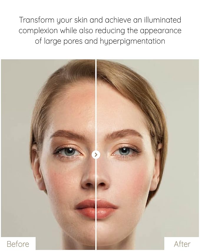 MASTINA White Mastic Ampoule Sheet Mask Pack of 12- Illuminating. Ultra-Moisturizing Facial Mask. Intensive Korean Skin Care. Fermented Mastic Gum