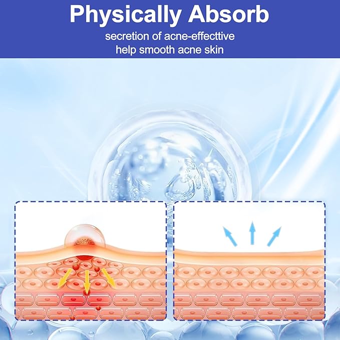 Pimple Patches for Face, 288 Hydrocolloid Acne Patches, Cute Round Shape Zit Covers, Patches for Covering Zits, Colorful Spot Stickers with Tea Tree, Salicylic Acid & Cica Oil