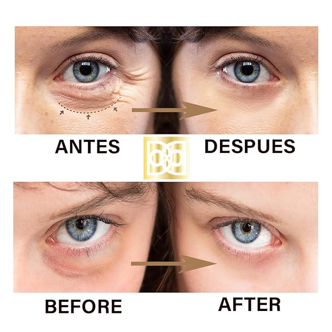 24K ULTIMATE Eye Care Set - Luxurious Anti-Aging Masks & Serum - Effective Under Eye Treatment for Puffiness, Dark Circles, Wrinkles