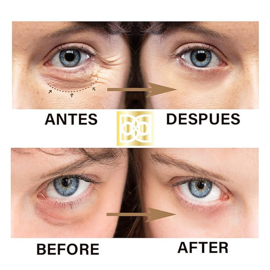 24K ULTIMATE Eye Care Set - Luxurious Anti-Aging Masks & Serum - Effective Under Eye Treatment for Puffiness, Dark Circles, Wrinkles