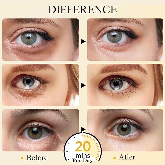 Under Eye Patches(24K Gold 15 Pairs), Gel Eye Mask for Reduce Dark Circles, Puffy Eyes,Undereye Bags, Wrinkles,-with Hyaluronic Acid & Collagen,Eye Treatment Skin Care for Men & Women Gift