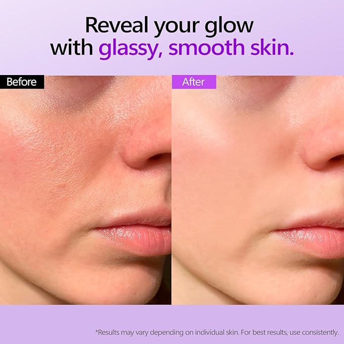 Retinol Peptide Serum 1.01 Oz – Anti-Aging, Hydrating & Firming for Wrinkles & Dark Spots, Gentle Retinol Serum for Face, Day & Night Korean Skincare