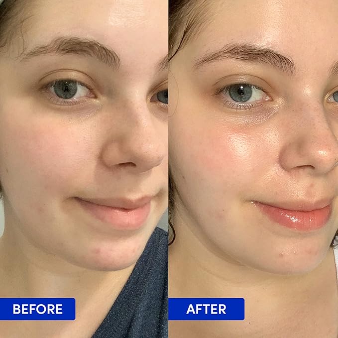 Sand & Sky Tasmanian Spring Water Deep Hydration Night Cream with 3x Hyaluronic Acid - Anti-Aging Repair Cream for Wrinkles, Boosts Collagen Production