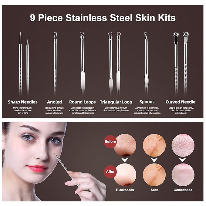 Newbealer Facial Steamer, Mini Aroma Face Steamer, Nano Ionic Hot Mist Face Humidifier for Facial Deep Cleaning, Home Sauna Spa Sprayer with 9 Pieces Acne Remover Kit (White-Gold, 160 ml)