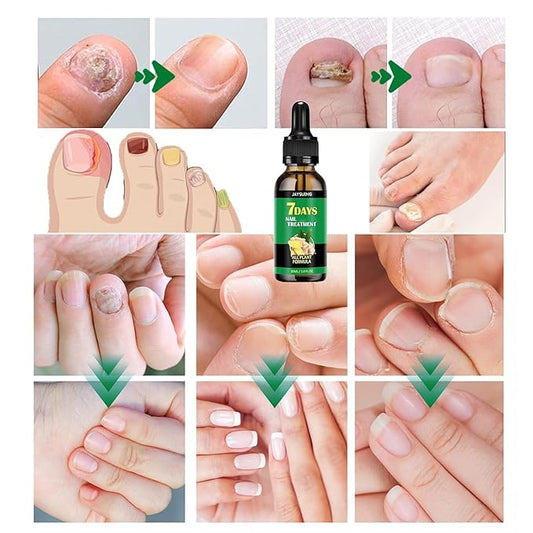 3PCS Ginger Nail Care Serum - Moisturize the Cuticle & Strengthen Nails and Helps Nails Healthy Grow