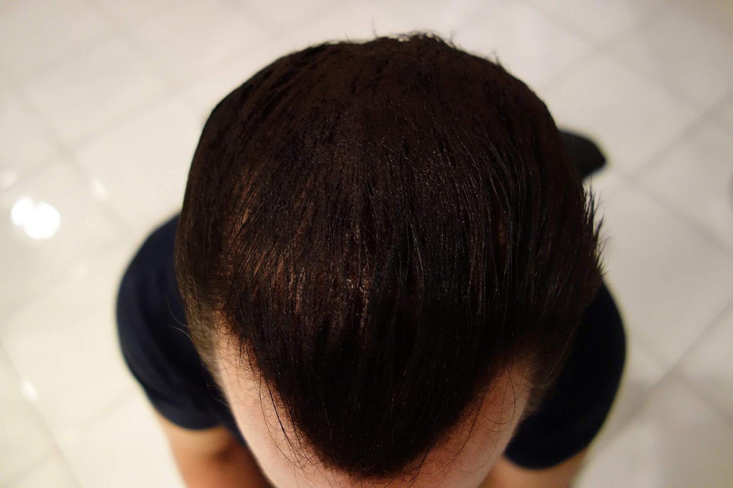 Hair Building Fibers 200 Grams 7 Oz. With Bottle By Finally Hair 50g*4 (Dark Blonde/Dark Blond)