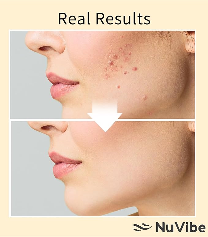 ADVANCED Snail Mucin 96% Essence – Hydrating Face Serum with Snail Secretion Filtrate for Dry, Dull Skin & Fine Lines | Korean Skin Care for Face, Eyes & Neck | 3.38 fl.oz (100ml)