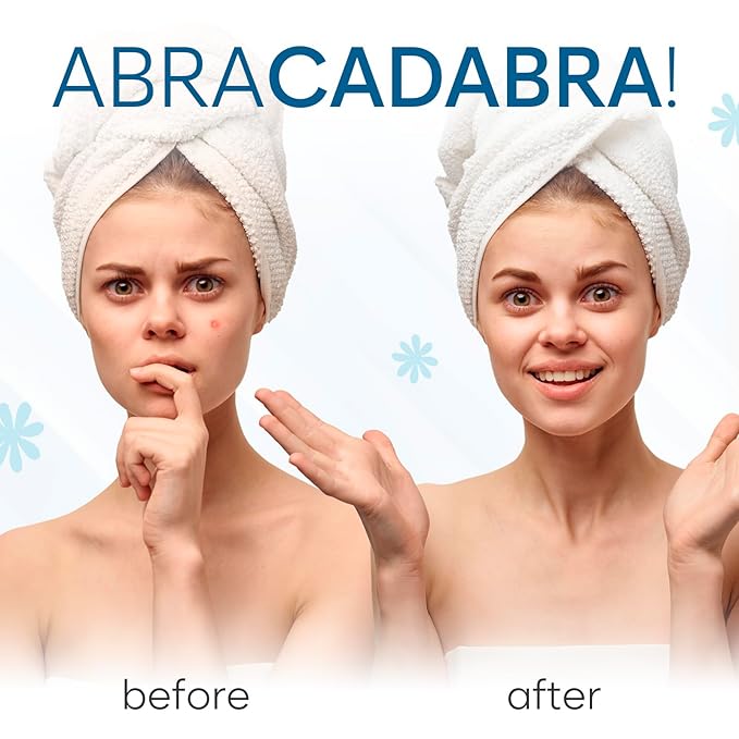 Invisible Pimple Patches (180 Count) - Hydrocolloid Acne Spot Treatment - Zit Patches for Face - Acne Treatment for Clear Skin - S/L Sizes