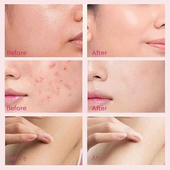 Japan Sakura Skin Care Set Women Gifts 11 Pcs - Skin Care for Teens 10-12 - Skincare for Girls 10-12 - Japanese Skin Care Routine Kit for Women with Sunscreen, Underarm Cream, Peeling Gel