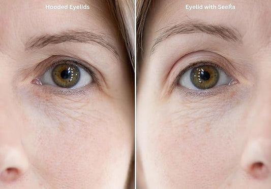 SeeRa: Instant Lifting Eyelid Tape for Hooded & Droopy Eyes - Hypoallergenic, Waterproof, Invisible Eye Lift Strips, Non-Surgical, Eyelid Lifters & Stickers-90pcs (4mm-7mm) (5mm-Intermediate)