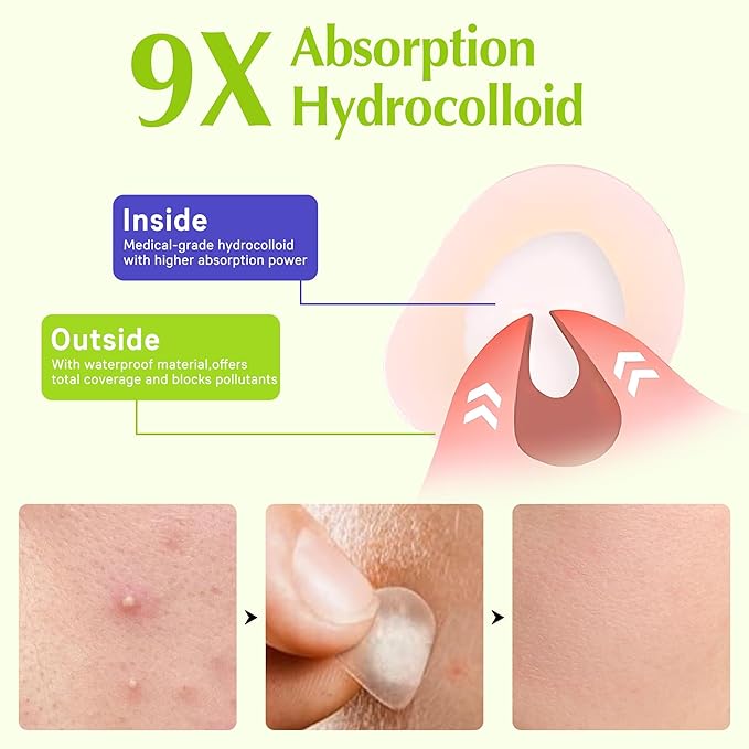 Pimple Patches For Face, Invisible Hydrocolloid Acne Patches Acne Treatment,Covering Zits & Blemishes in Skin and Face, Zit Patches with Salicylic Acid, FSA HSA Store Eligible Items 36 Count