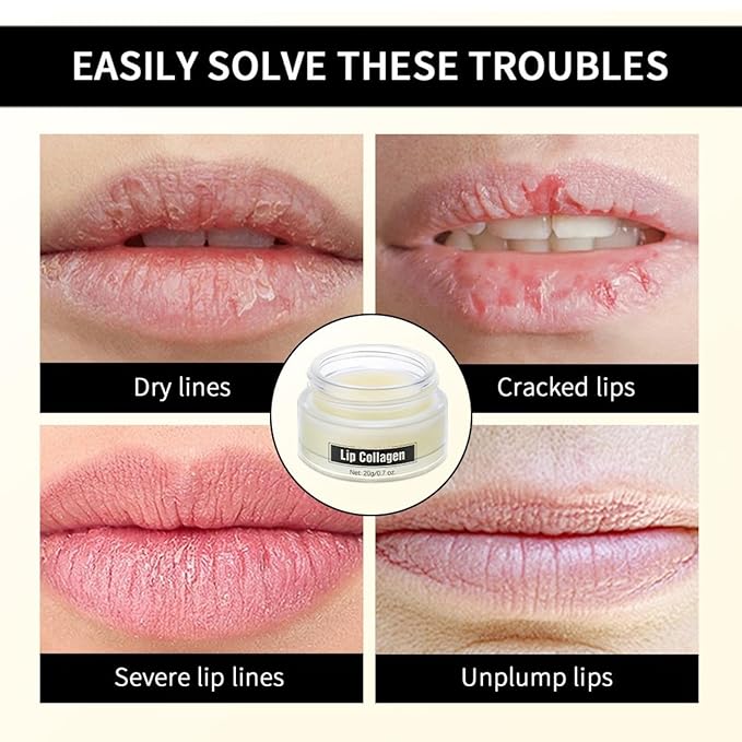 Lip Sleeping Mask - Lip Balm Hydrating - Lip Mask Overnight - Lip Butter Balm - Lip Moisturizer for Very Dry Lips - Extreme Dry Lips Treatment - Lip Plumper for Women - Lip Filler Lip Collagen