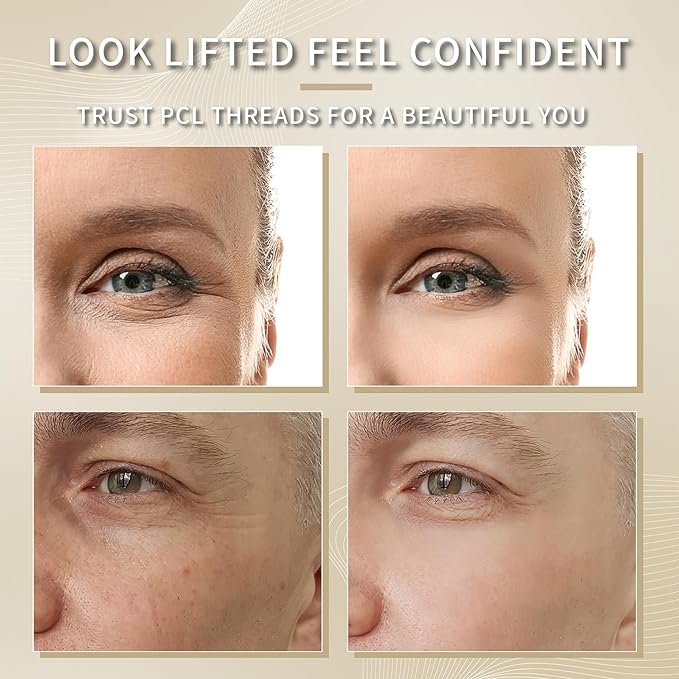 elves PCL Threads for Face Lift Mono Threads 30G38mm Pcl Smooth Threads Sharp Tip PCL Threads Mono 20Pcs Long-Lasting Skin Tightening Smoothing of Wrinkles